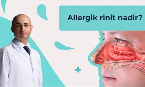 Allergik Rinit və Onun Düzgün Müalicəsi