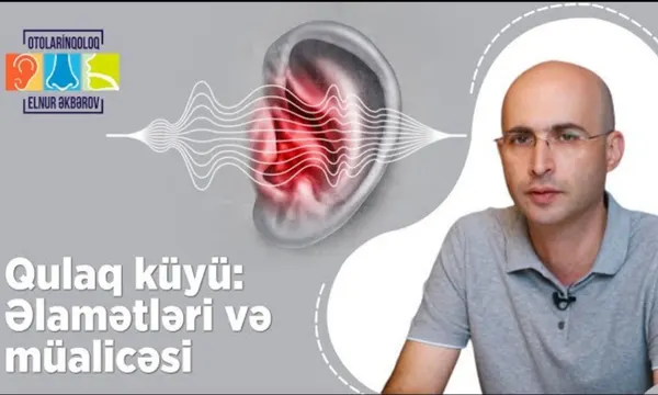 Tonzillit Nə Zaman Əməliyyat Tələb Edir?