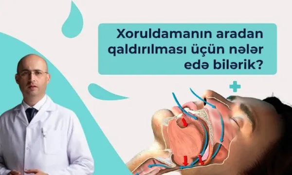 Qulaq Təmizliyi və Qulaq Küyü