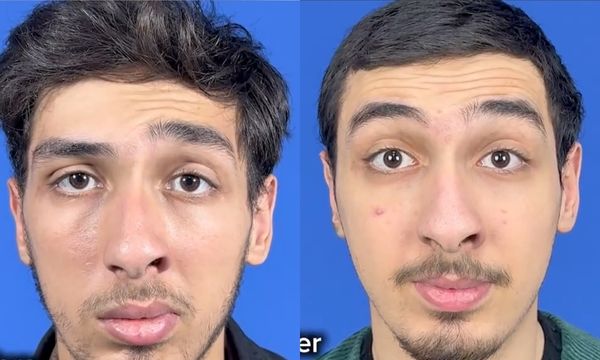 Əməliyyat nəticəsi 10