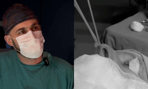 Sinus cərrahiyyəsi