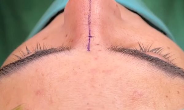 Əməliyyat nəticəsi 7