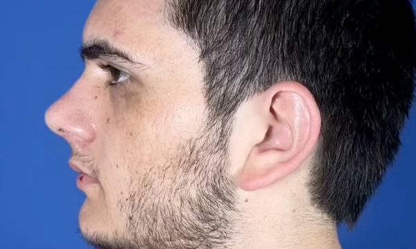 Əməliyyat nəticəsi 8